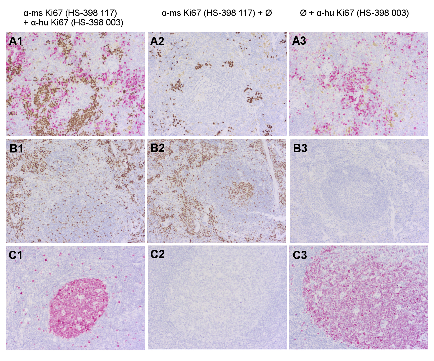Immunohistochemical doublestaining of formalin fixed paraffin embedded (FFPE) mouse (A1-3: mouse spleen engrafted with human CD34+-cells; B1-3: wildtype mouse spleen) and human (C1-3: human tonsil) tissues using rabbit anti-human Ki67 (cat. no. HS-398 003, AP-RED, red) and rat anti-mouse Ki67 (cat. no. HS-398 117, DAB, brown).