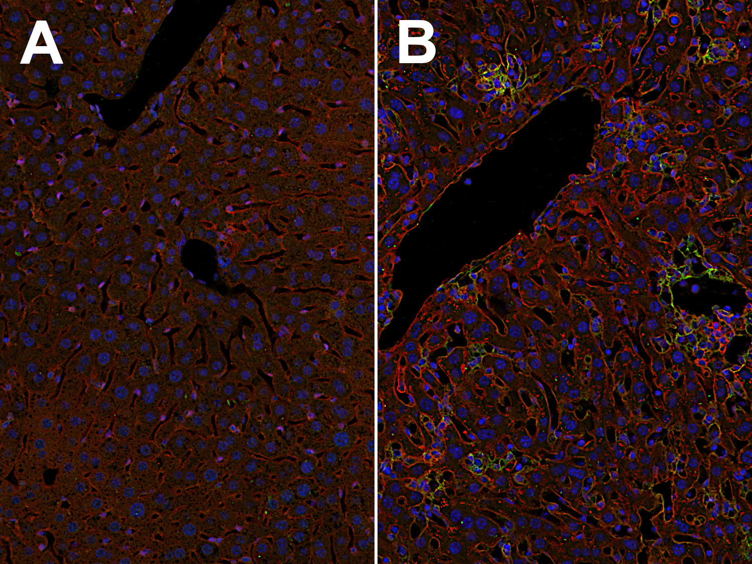 Indirect immunostaining of formalin fixed paraffin embedded (FFPE) mouse liver sections of a non-infected mouse (A) and a T. gondii-infected mouse (B) with rabbit anti-ICAM1 antibody (cat. no. HS-532 003, dilution 1:500, red) and guinea pig anti-VCAM1 antibody (cat. no. HS-470 004, dilution 1:500, green). Nuclei have been visualized by DAPI staining (blue).