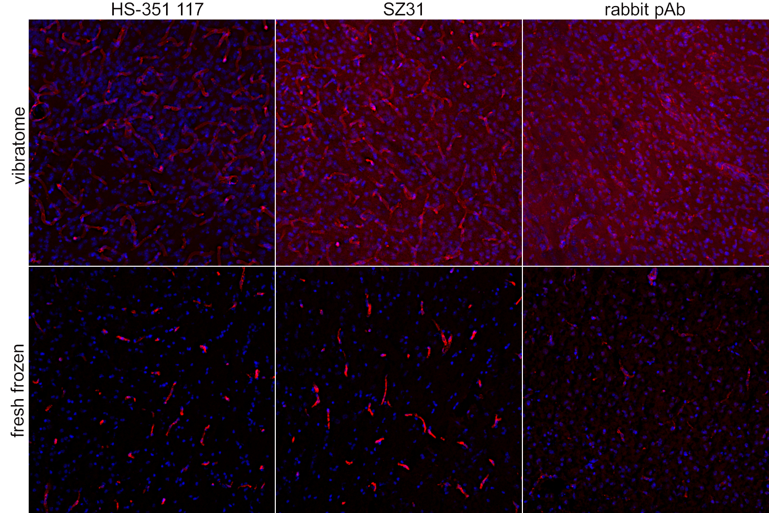 Three columns of pictures showing results in CD31 stainings