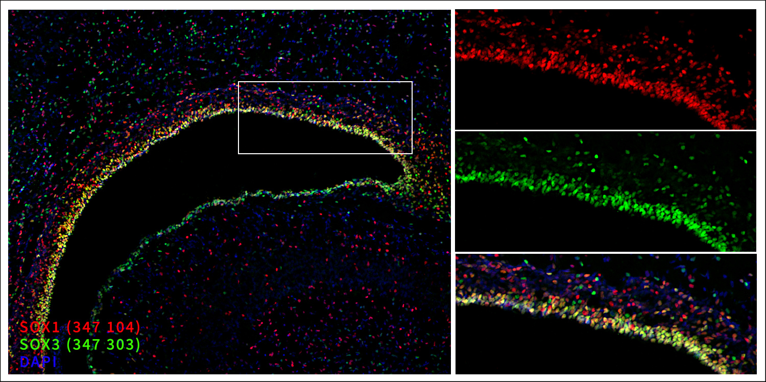 Markers of the ventricular zone (VZ), SOX1 and SOX3. Indirect immunostaining of a formaldehyde-fixed rat brain section (newborn P0, ventricle) with guinea pig anti-SOX1 antibody (cat. no. 347 104, dilution 1 : 2000, red) and rabbit anti-SOX3 antibody (cat. no. 347 303, dilution 1 : 500, green). Nuclei were visualized with DAPI staining (blue).