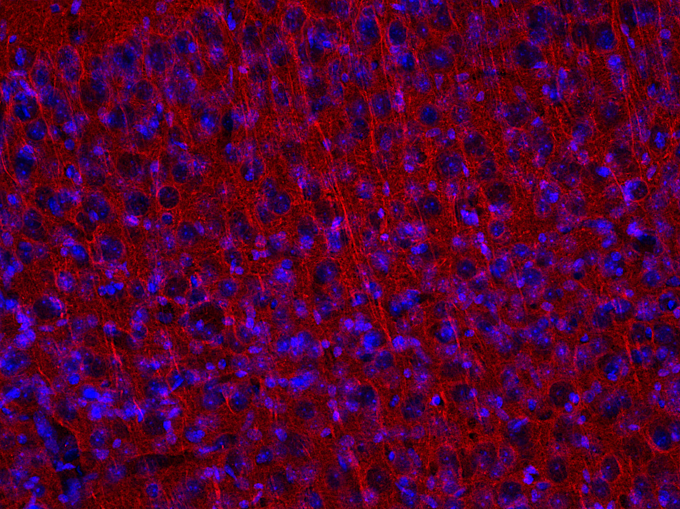 Figure 5: Indirect immunostaining of PFA fixed mouse cortex section with mouse anti-β3-Tubulin 