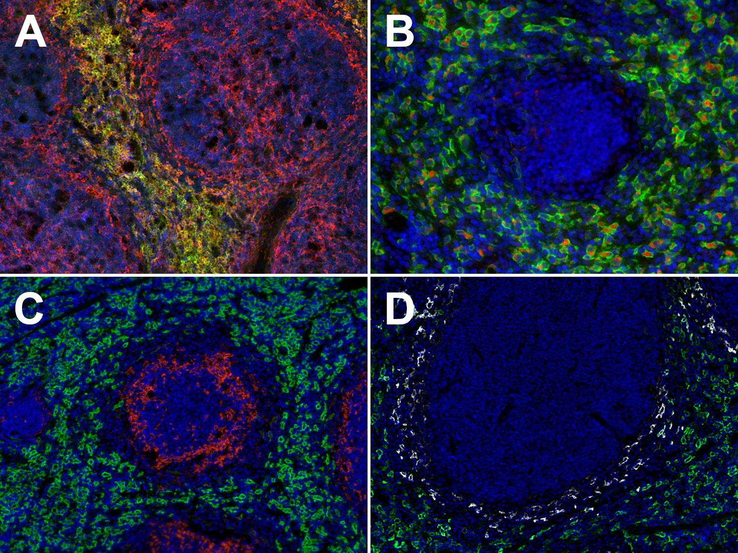 Immunohistochemical doublestaining of mouse spleen sections using different antibody combinations