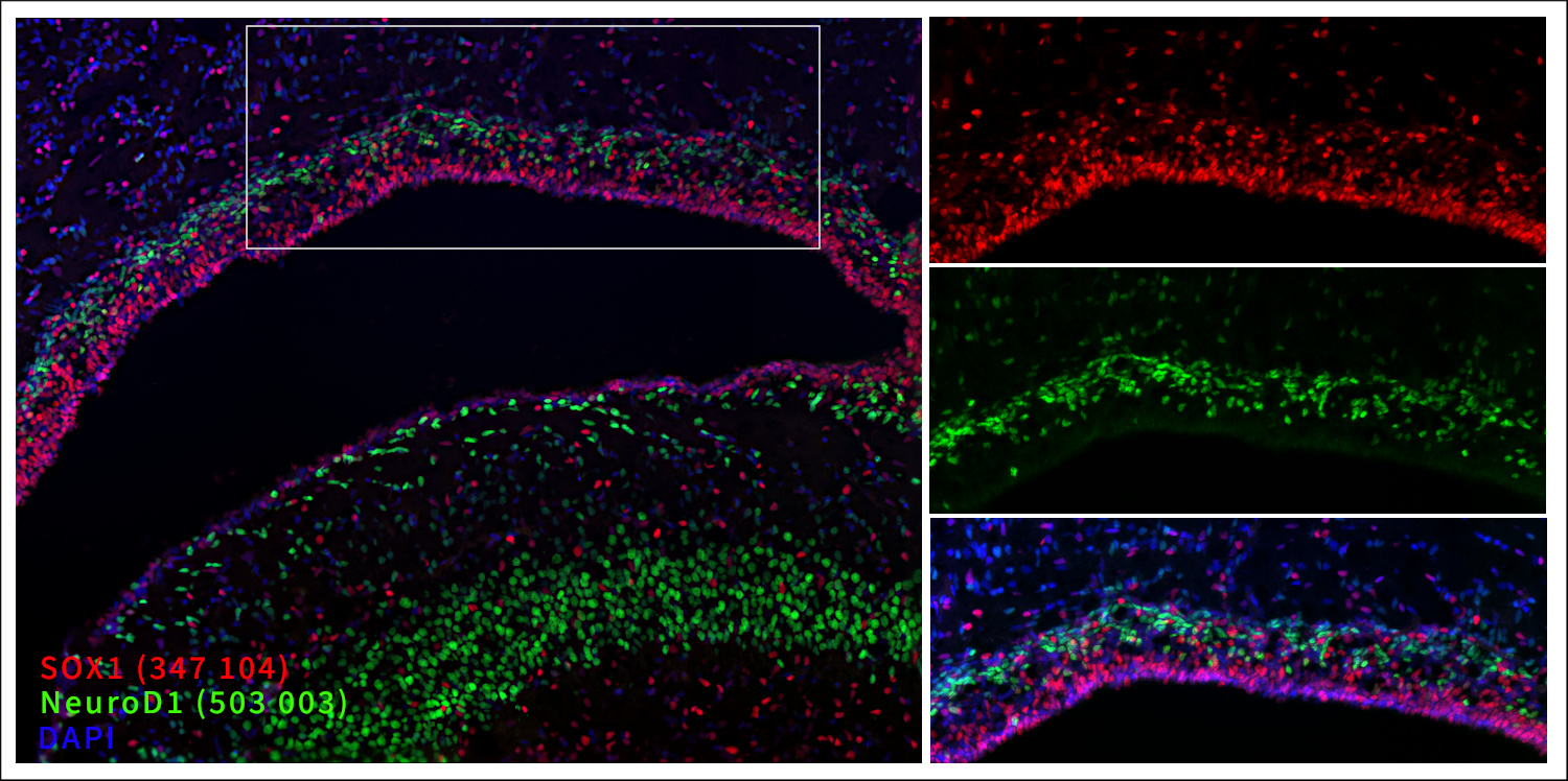Markers of the ventricular zone (VZ, SOX1, red) and upper subventricular zone (SVZ, NeuroD1, green). Indirect immunostaining of a formaldehyde-fixed rat brain section (newborn P0, ventricle) with guinea pig anti-SOX1 antibody (cat. no. 347 104, dilution 1 : 2000, red) and rabbit anti-NeuroD1 antibody (cat. no. 503 003, dilution 1 : 2000, green).