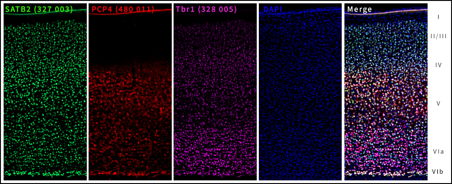 Markers of deep layer VI, PCP4 and Tbr1. Indirect immunostaining of a formaldehyde-fixed adult mouse cortex section with rabbit anti-SATB2 (cat. no. 327 003, dilution 1 : 1000, green), mouse anti-PCP4 (cat. no. 480 011, dilution 1 : 500, red) and guinea pig anti-Tbr1 (cat. no. 328 005, dilution 1 : 500, purple). Nuclei were visualized with DAPI staining (blue).