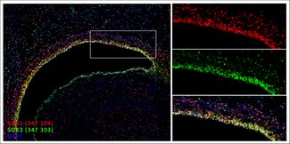 Markers of the ventricular zone (VZ), SOX1 and SOX3. Indirect immunostaining of a formaldehyde-fixed rat brain section (newborn P0, ventricle) with guinea pig anti-SOX1 antibody (cat. no. 347 104, dilution 1 : 2000, red) and rabbit anti-SOX3 antibody (cat. no. 347 303, dilution 1 : 500, green). Nuclei were visualized with DAPI staining (blue).