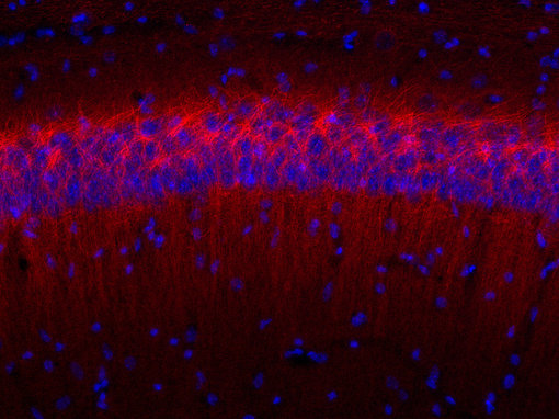 Indirect immunostaining of PFA fixed mouse hippocampus section with Guinea pig anti-Ankyrin G 