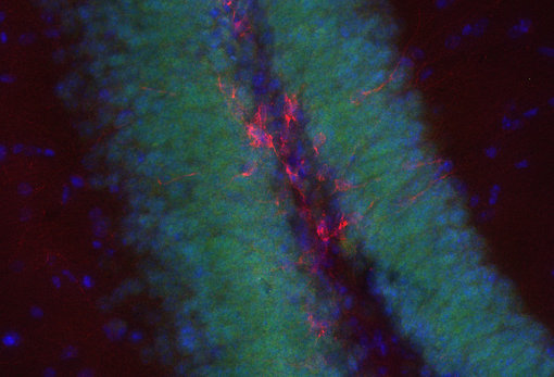 Indirect immunostaining of PFA fixed rat hippocampus sections with rabbit anti-Doublecortin