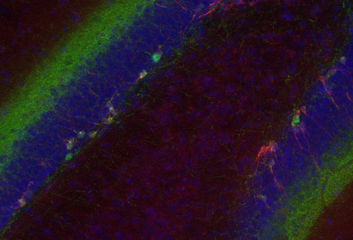 Indirect immunostaining of PFA fixed mouse hippocampus section with chicken anti-Doublecortin