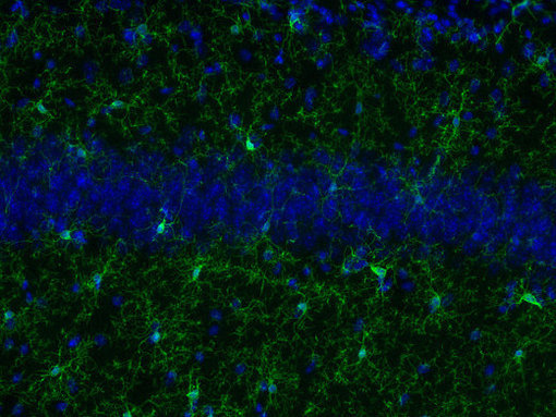 Indirect immunostaining of microglia in a PFA fixed mouse hippocampus section with anti-IBA1