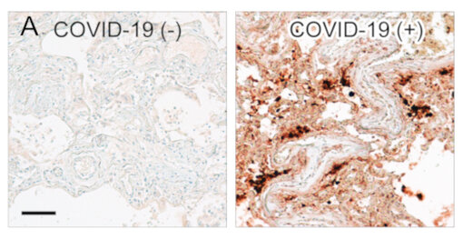 Mouse anti-SARS-CoV-2 nucleocapsid (clone 4A8)	