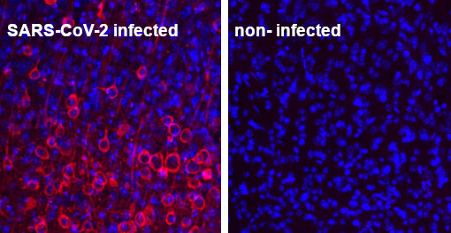 indirect immunostaining of PFA fixed mouse brain sections