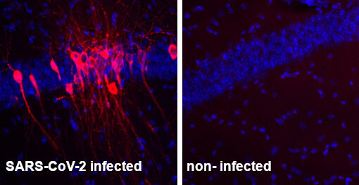 indirect immunostaining of PFA fixed mouse brain sections