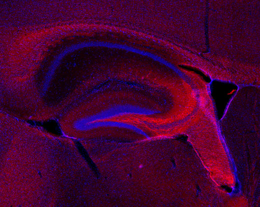 Indirect immunostaining of PFA fixed mouse hippocampus section with mouse anti-Neurofilament L