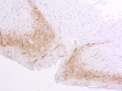 Indirect immunostaining of PFA fixed paraffin embedded rat spinal cord section with guinea pig anti-CGRP antibody