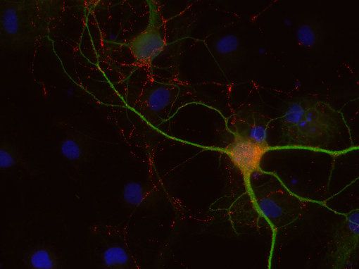 Indirect immunostaining of PFA fixed rat hippocampus neurons with guinea pig anti-CCK-8 antibody