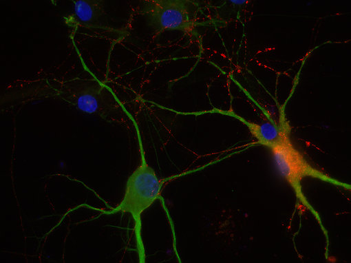 Indirect immunostaining of PFA fixed rat hippocampus neurons with guinea pig anti-VIP