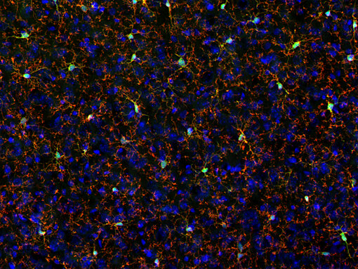 P2Y12 is expressed in resting microglia. Indirect immunostaining of PFA fixed mouse cortex section with anti-P2Y12 (Cat. 476 011, 1:2000, red) and anti-IBA1 (cat. no. 234 308, 1:500, green). Nuclei were stained with hematoxlin.