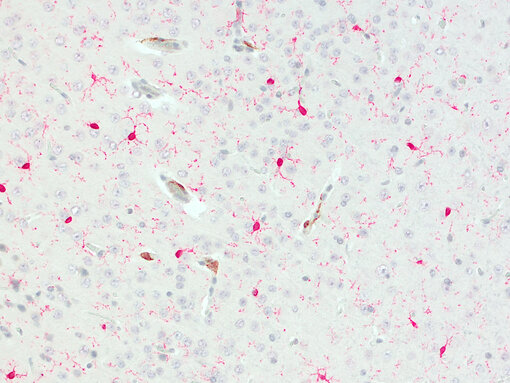 CD206 positive BAMs are located at blood vessels