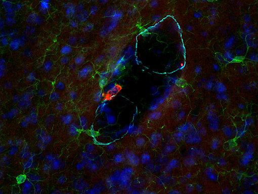 CD163 co-localized with IBA1 in perivascular macrophages.