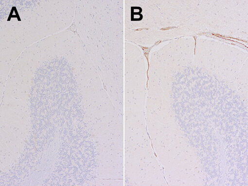 Indirect immunostaining of formalin fixed paraffin embedded (FFPE) mouse brain (cerebellum) sections of a non-infected mouse (A) and a SARS-CoV2 infected mouse (B) with guinea pig anti-VCAM1 antibody (cat. no. HS-470 004, dilution 1:750, DAB, brown). Nuclei have been visualized by hematoxylin staining (blue).