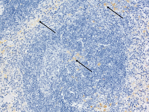 Siderin (arrows, yellow) in formalin fixed paraffin embedded (FFPE) mouse spleen. Nuclei have been visualized by hematoxylin staining (blue).
