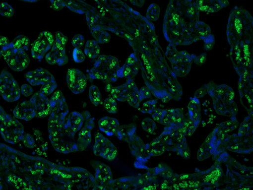 Autofluorescence in formalin fixed paraffin embedded (FFPE) human placenta. Autofluorescence of red blood cells is shown in green. Nuclei have been visualized by DAPI staining (blue).