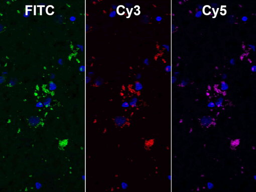 Lipofuscin-associated autofluorescence in PFA fixed human brain in FITC, Cy3 and Cy5 channels. Nuclei have been visualized by DAPI staining (blue).