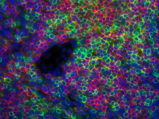 Non-colocalized markers in mouse spleen. Indirect immunostaining of a formalin fixed paraffin embedded (FFPE) mouse spleen section using rabbit anti-mouse CD8a (cat. no. HS-361 008, dilution 1:100, green) and rat anti-mouse CD4 (cat. no. HS-360 117, dilution 1:100, red).
