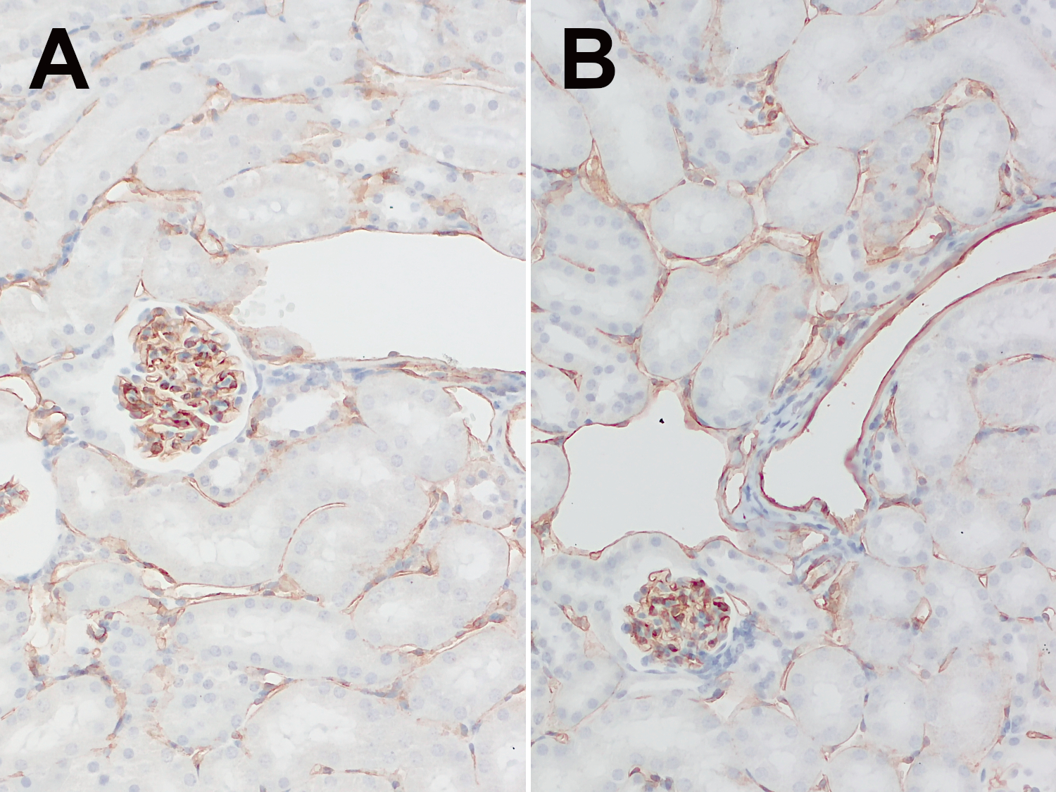 Anti-mouse CD31 staining in FFPE mouse kidney sections. A: anti-mouse CD31 rat mAb HS-351 117 (1:1000). B: anti-mouse CD31 rb recombinant mAb HS-351 008