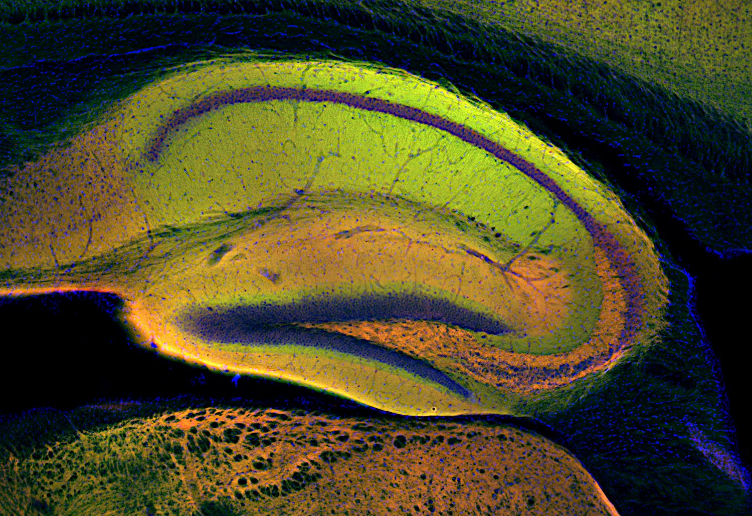 CSP, Polyclonal Guinea pig antiserum
