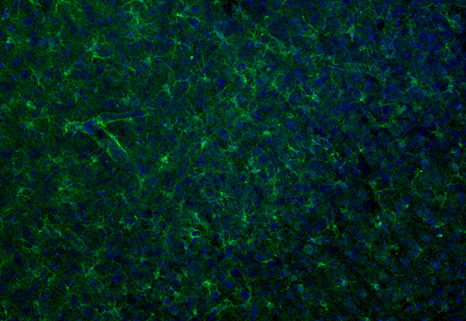 S100B Polyclonal Guinea pig antiserum - image 4