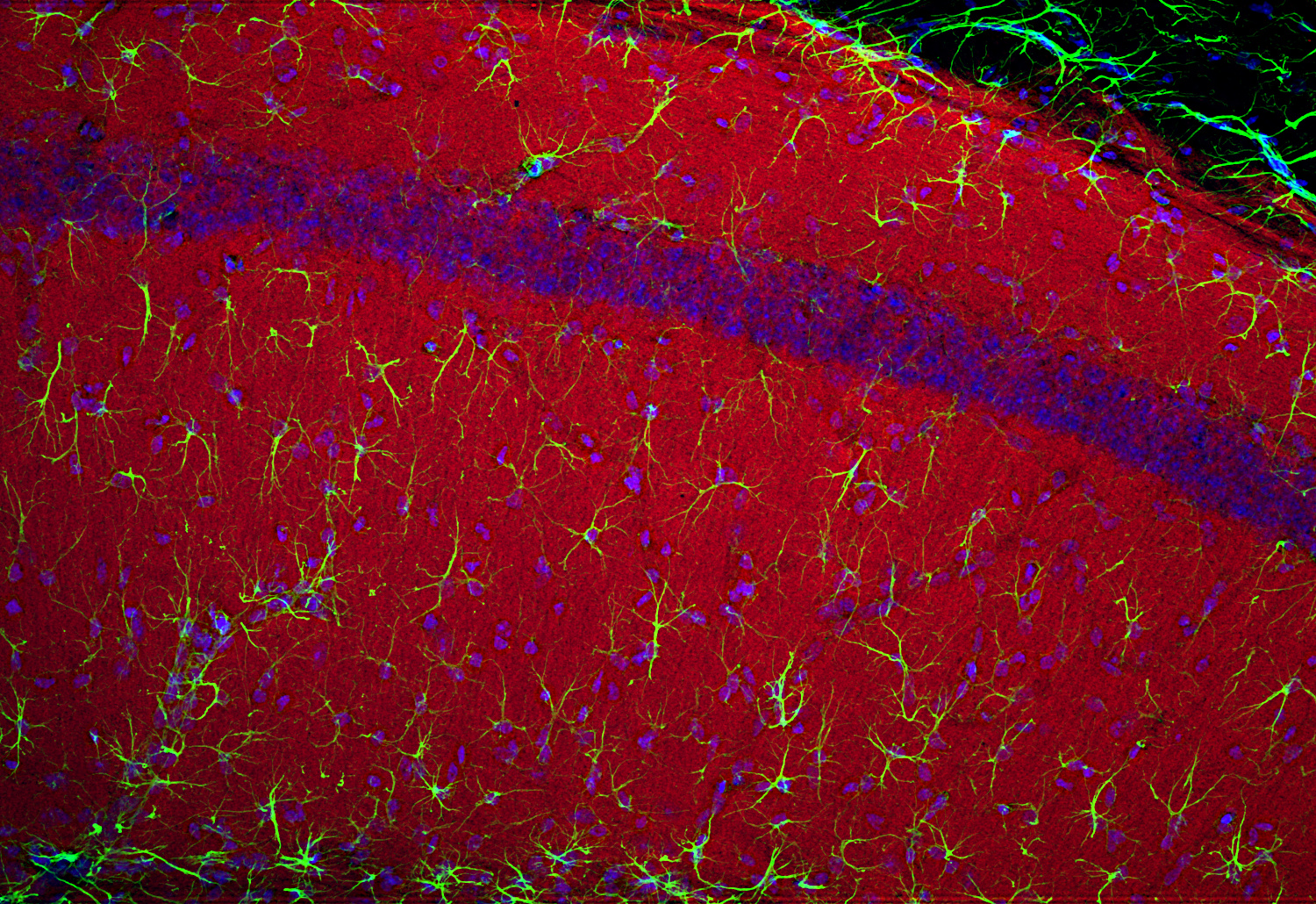 CSP, Polyclonal Guinea pig antiserum
