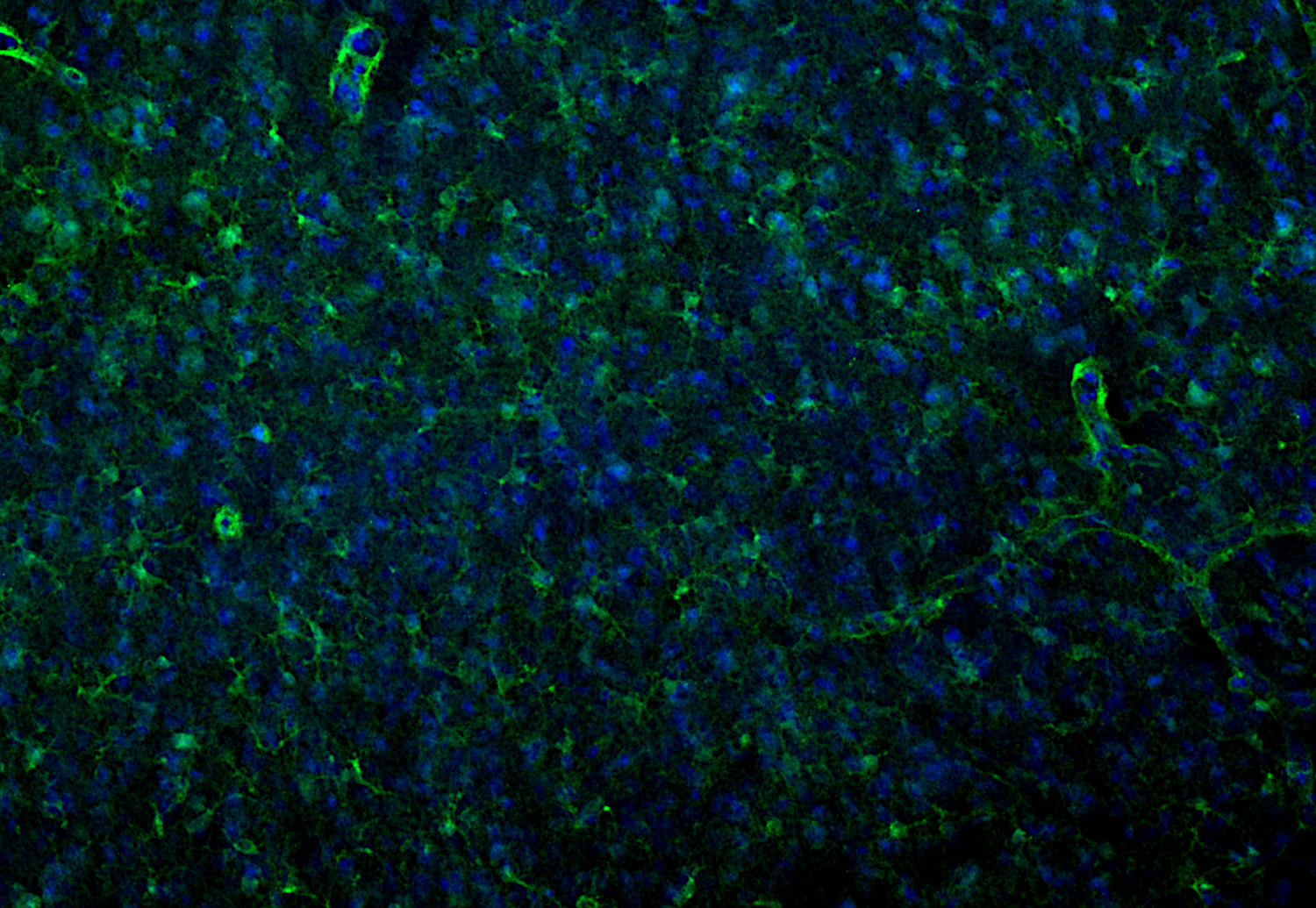 S100B Polyclonal Guinea pig antiserum - image 5