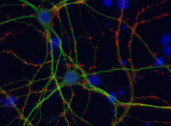 Synaptophysin1 Polyclonal chicken IgY fraction - image 2