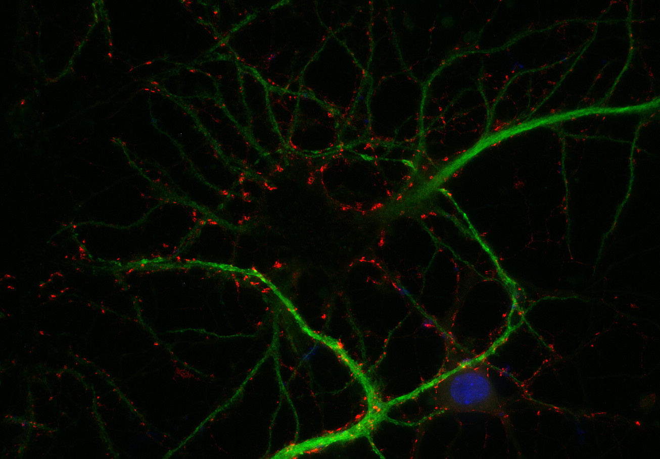 Synaptoporin Polyclonal rabbit antiserum - image 2