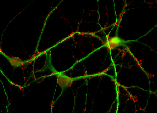 Synaptogyrin1 Polyclonal rabbit antiserum - image 2