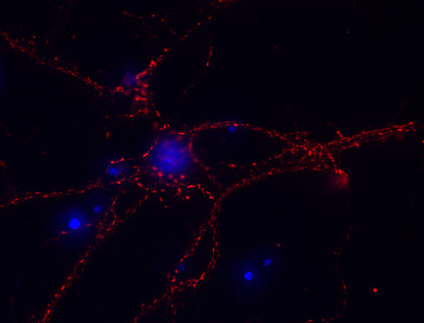 Synaptogyrin3 Polyclonal rabbit antiserum - image 2