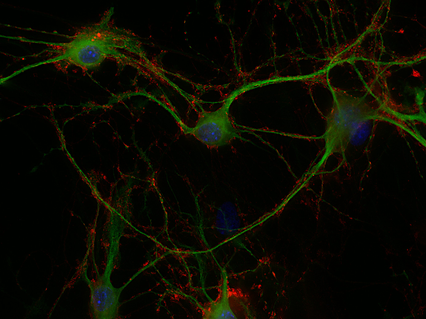 VAMP1/2/3 Polyclonal rabbit antiserum - image 2