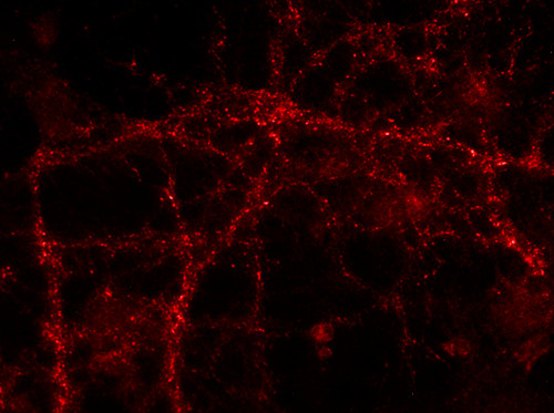 VAMP1/2/3 Polyclonal Guinea pig antiserum - image 2