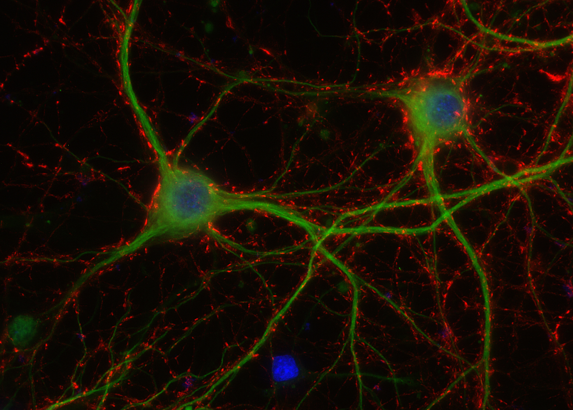 Synaptotagmin1 Recombinant rabbit - image 2