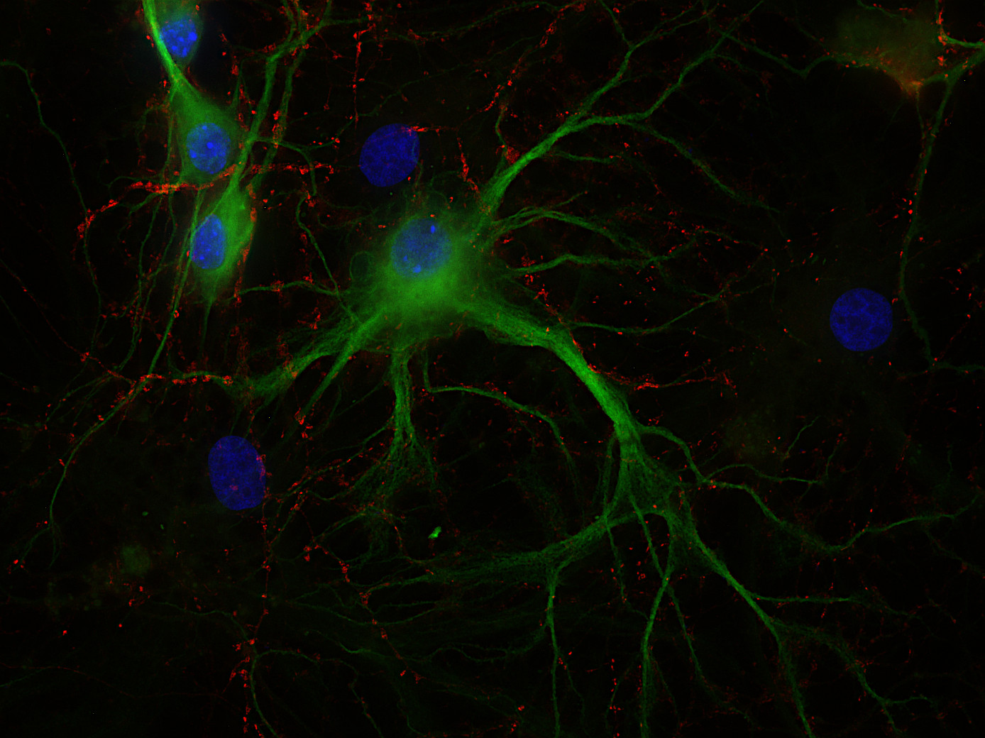 Synaptotagmin1 Polyclonal rabbit antiserum - image 2