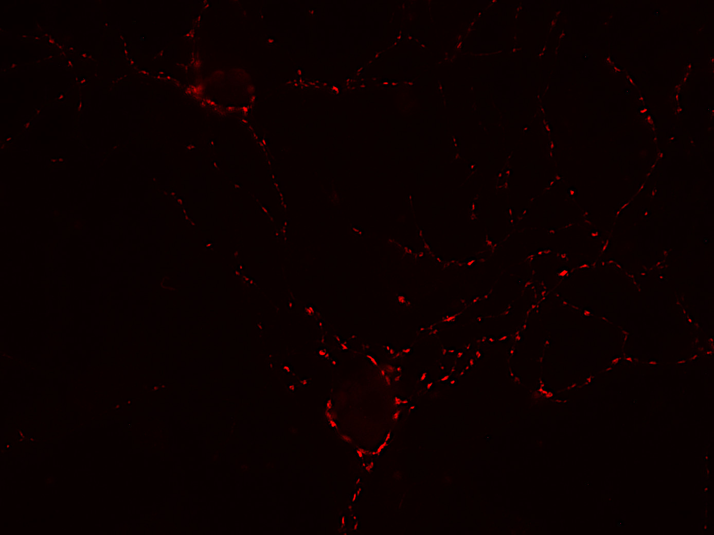 Synaptotagmin2 Polyclonal rabbit antiserum - image 2