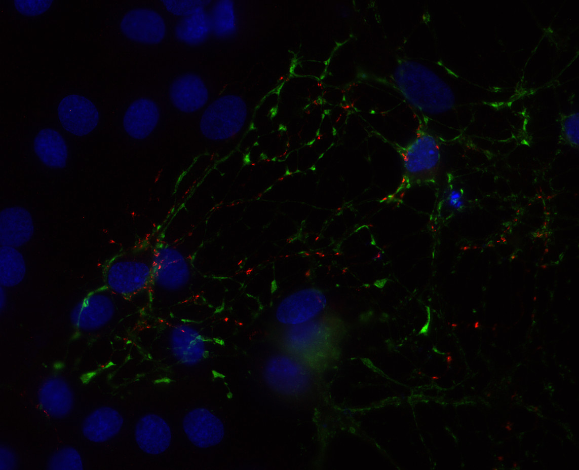 Synaptotagmin2 Polyclonal Guinea pig antiserum - image 2