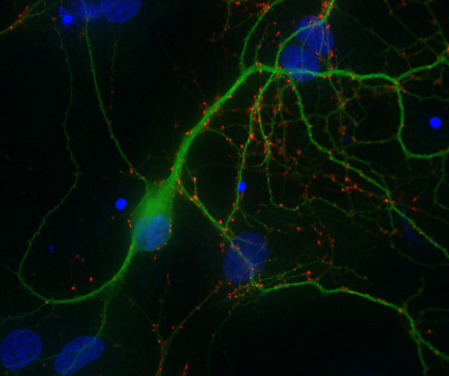 Synapsin1 Polyclonal Guinea pig antiserum - image 2