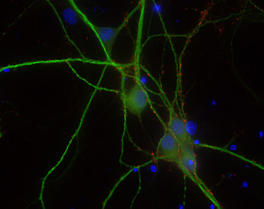 Synapsin3 Polyclonal Guinea pig antiserum - image 2