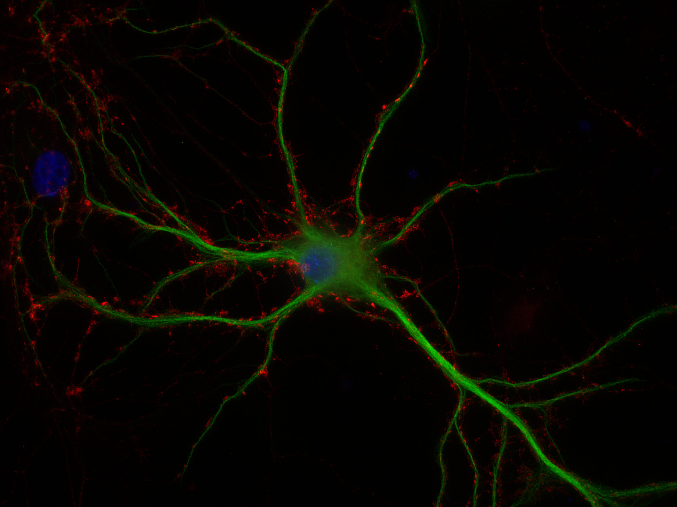 Rab3a Polyclonal rabbit antiserum - image 2