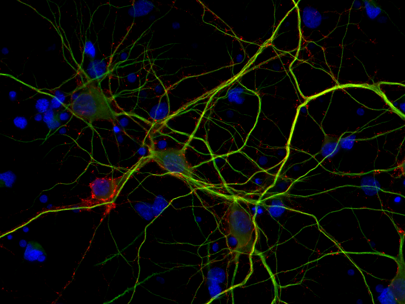Rab3a Recombinant rabbit - image 2