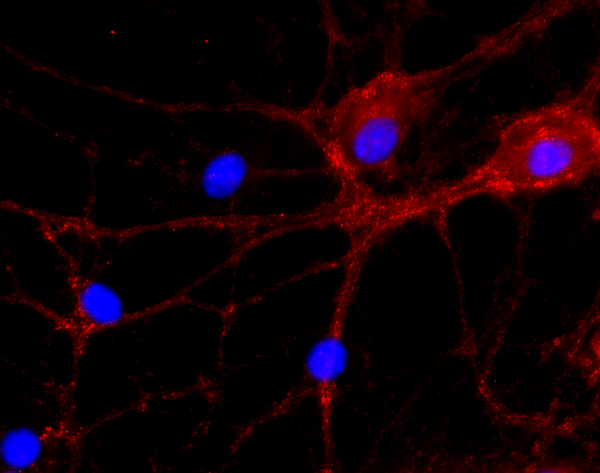 Proton ATPase Polyclonal rabbit antiserum - image 2