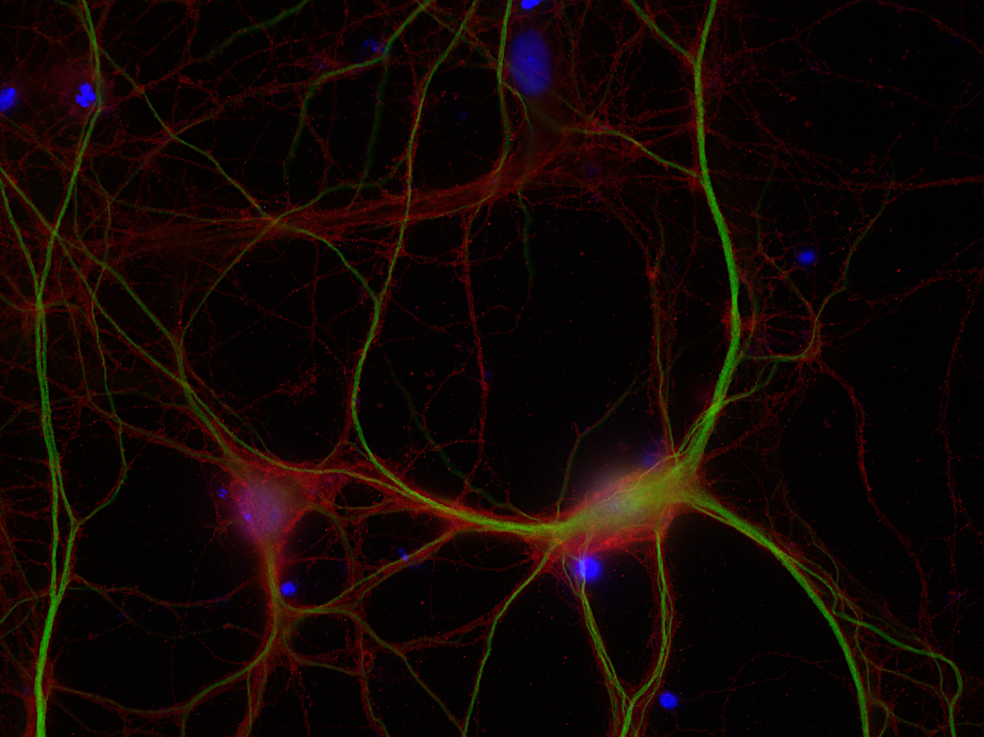 Syntaxin1B Polyclonal rabbit purified antibody - image 2