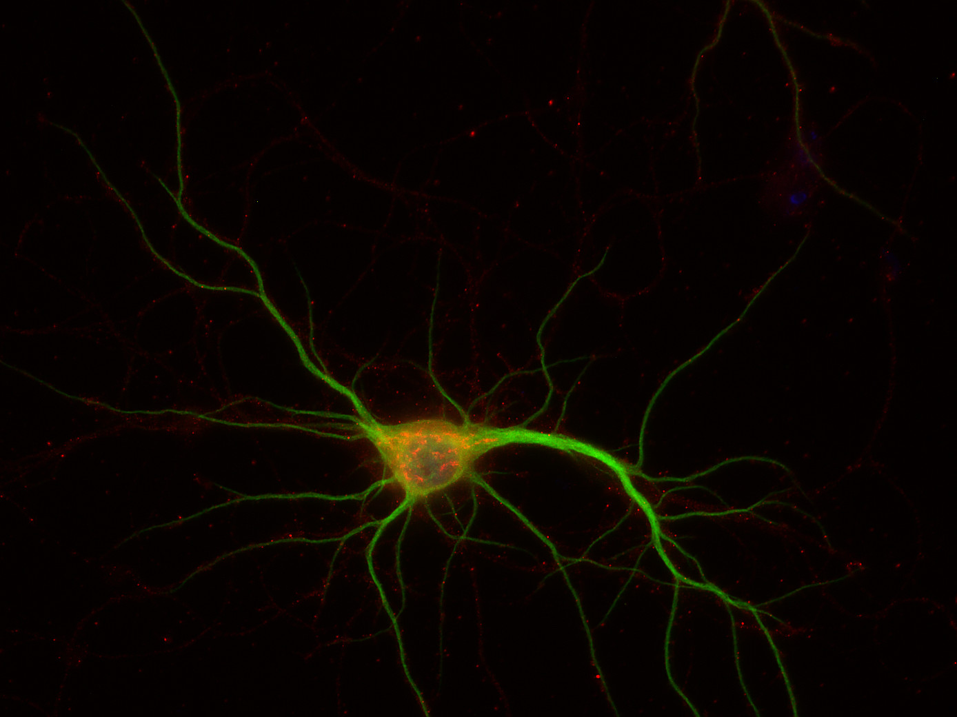 SNAP47 Polyclonal rabbit purified antibody - image 2